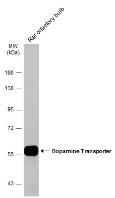 Dopamine Transporter antibody
